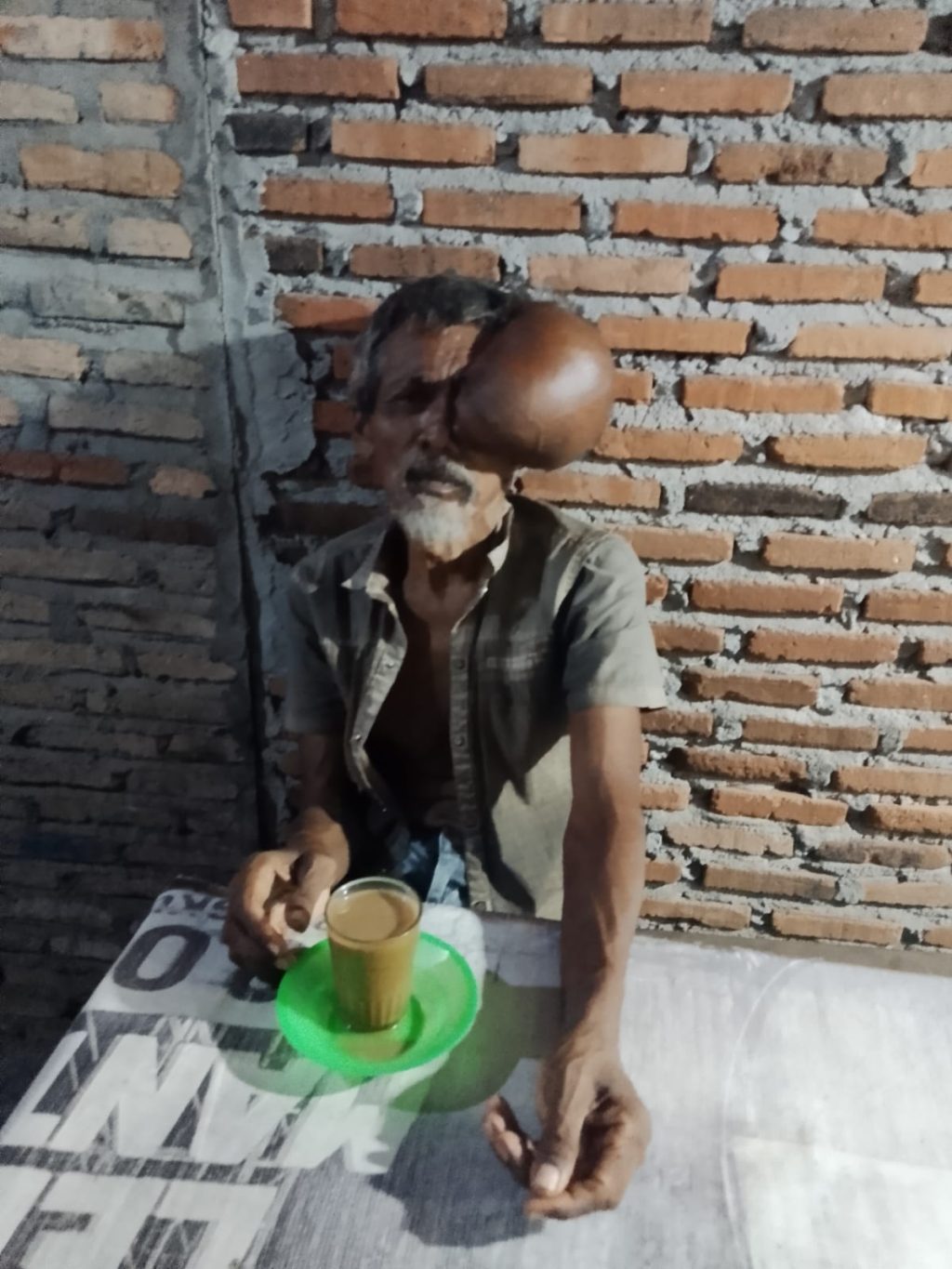 Perjuangan Warga Kampung Turi, Tebingtinggi Melawan Kangker: Butuh Uluran Tangan dan Empati Warga 1 IMG-20250612-WA0034